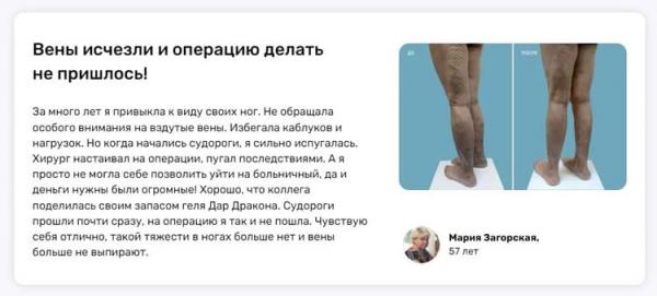 Дар Дракона — гель от варикоза купить по цене 147 ₽ в Москве на ...