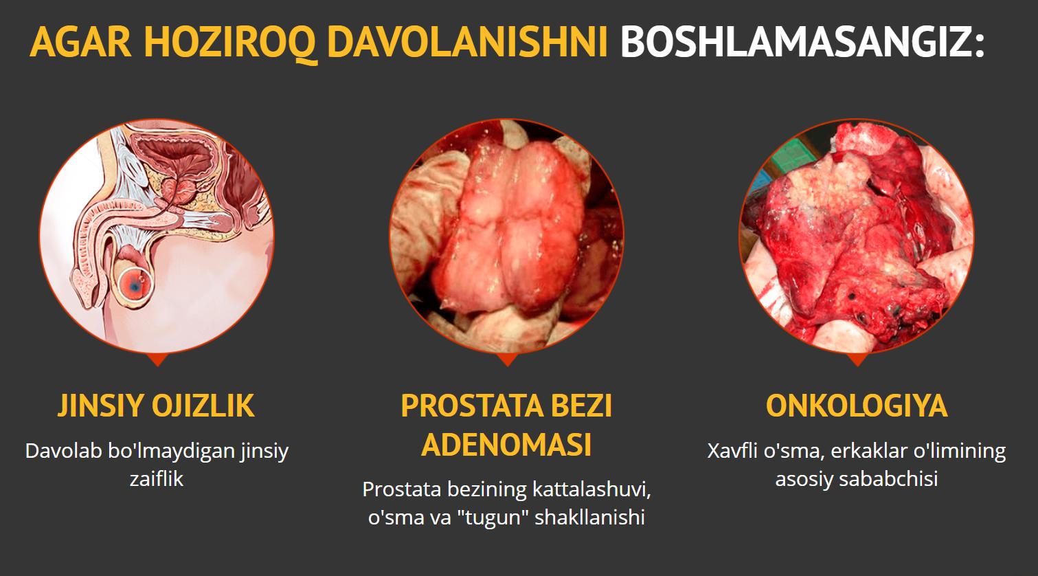 Beyonce porno komikslar